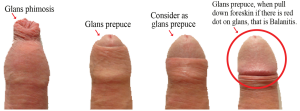 man-circumcised vs uncircumcised